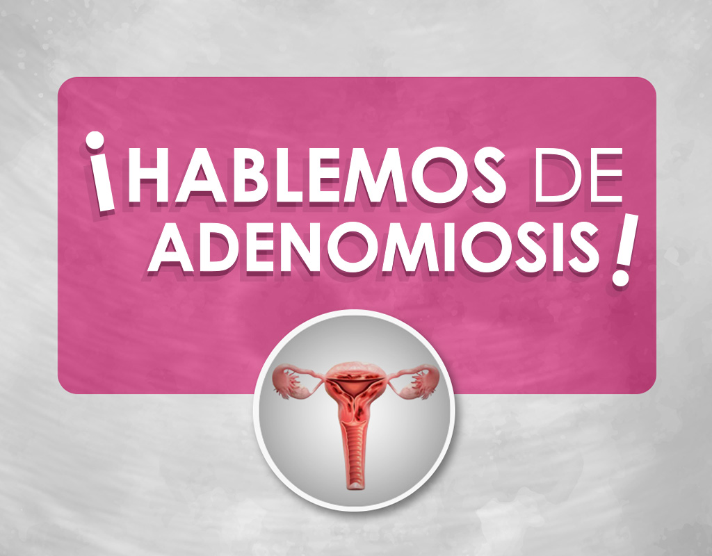 HABLEMOS DE ADENOMIOSIS